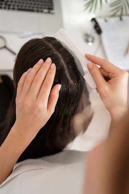 How Finasteride Works