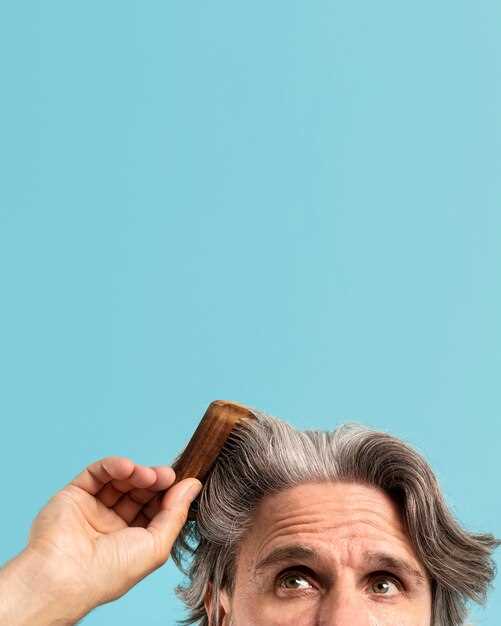 Key benefits of using Finasteride for hair loss: