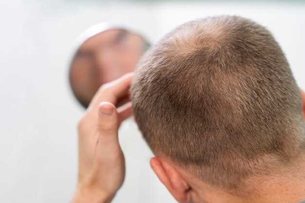 Effective Treatment for Male Pattern Baldness