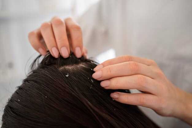 1. Keep the scalp clean: