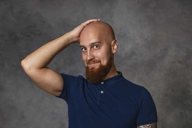 Bald truth finasteride