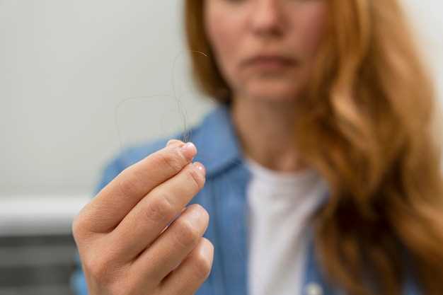 Chute de cheveux finasteride