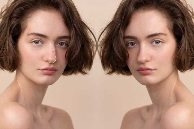 Finasteride before and after images