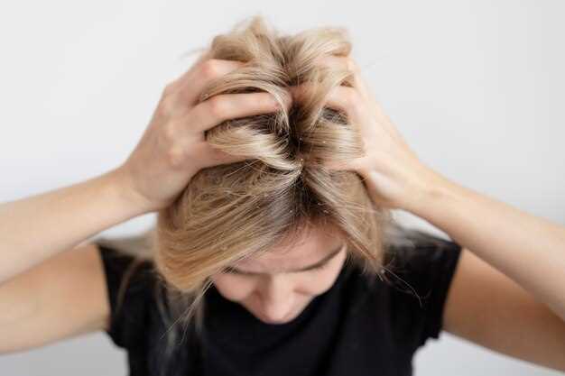 Finasteride contro caduta dei capelli