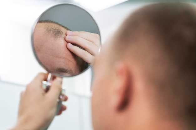 Finasteride crown hair loss
