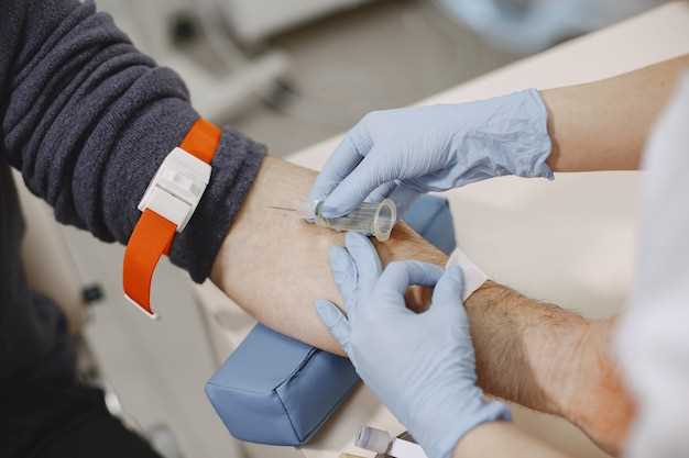 Finasteride donar sangre