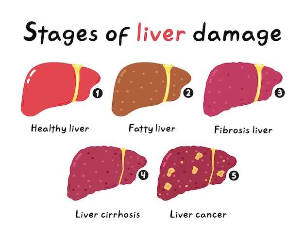 Finasteride fatty liver