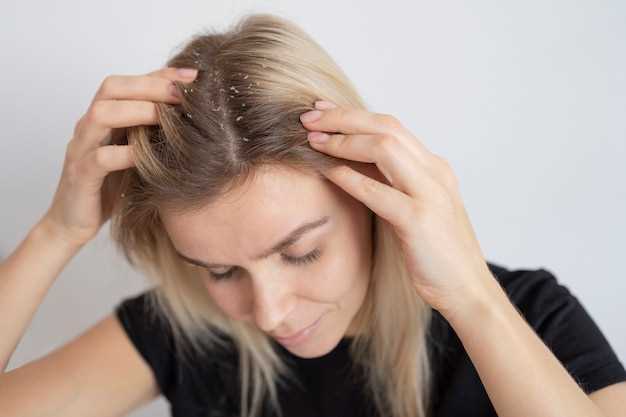 Finasteride haaruitval bijwerkingen