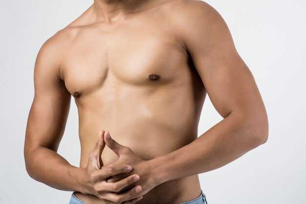 Gynecomastia after finasteride